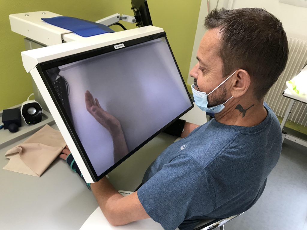 Felix Gretarsson : Une double greffe des bras réussie, un exploit médical à Lyon