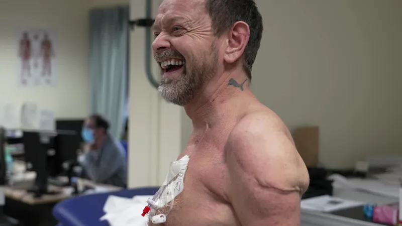 Felix Gretarsson : Une double greffe des bras réussie, un exploit médical à Lyon