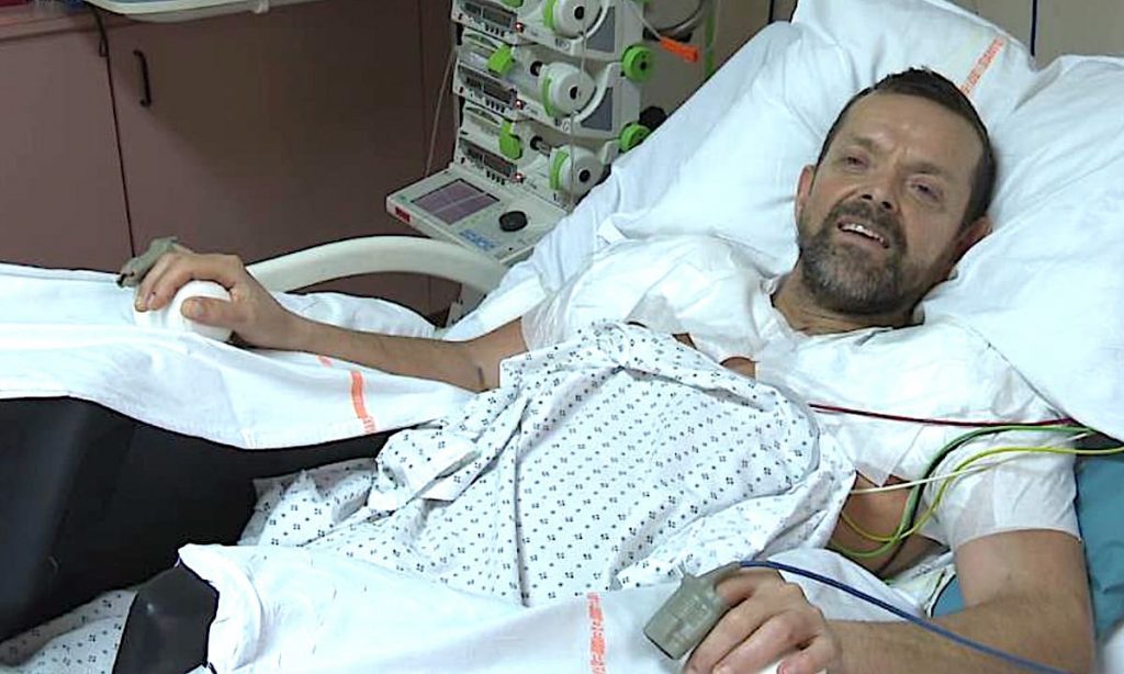 Felix Gretarsson : Une double greffe des bras réussie, un exploit médical à Lyon