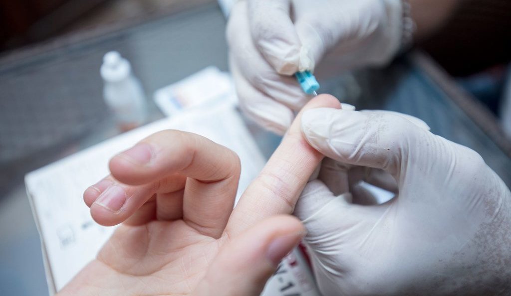 Santé sexuelle en Gironde : où se faire dépister du VIH début décembre