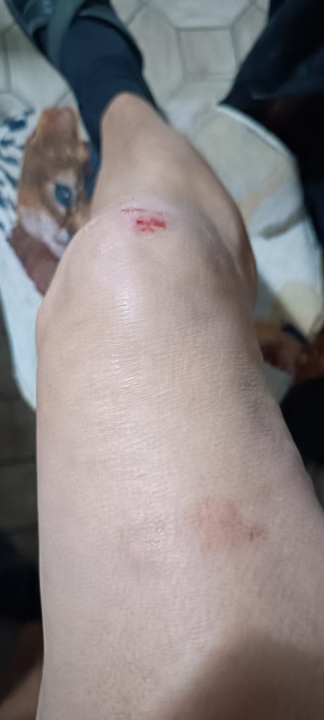 « Tout a été filmé » : accusé d’avoir agressé une directrice d’école et une mère d’élève, il livre sa version au Bulletin Bordelais