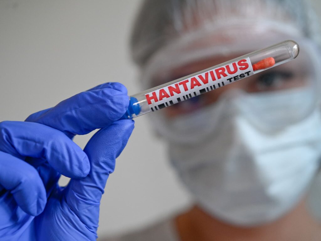 Alerte hantavirus : un patient hospitalisé en Nouvelle-Aquitaine ?