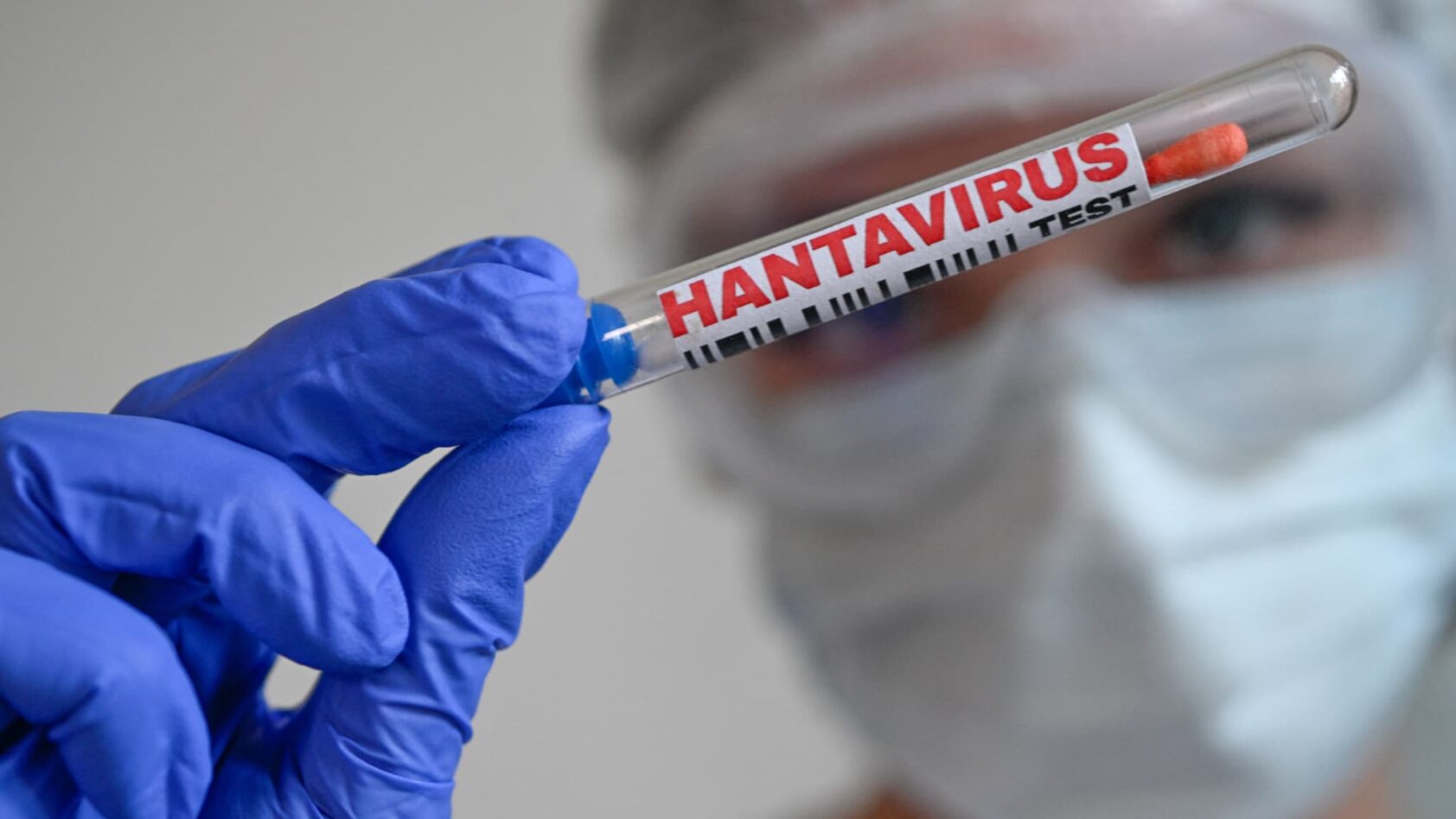 Alerte hantavirus : un patient hospitalisé en Nouvelle-Aquitaine ?